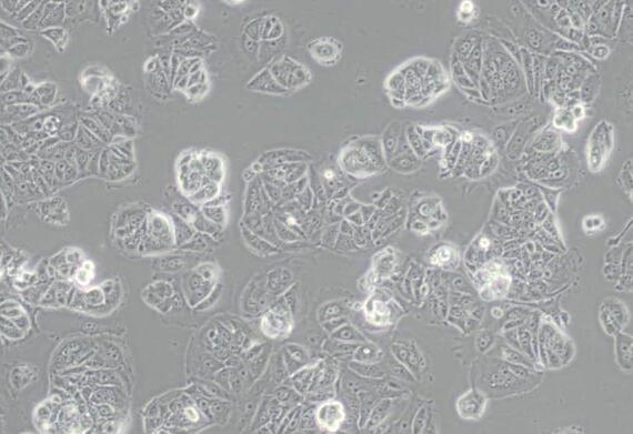 MCF7 [MCF-7]（人乳腺癌细胞）