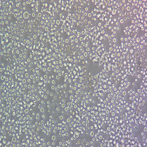 HBL-1-LUC（人弥漫大B淋巴瘤细胞-荧光素酶标记（STR鉴定正确））