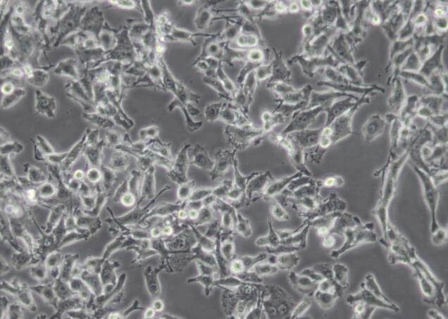 MFC（小鼠胃癌细胞）