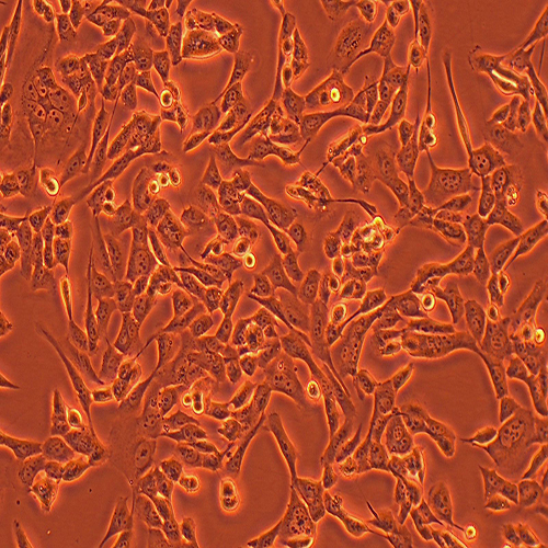 HOS-LUC（人骨肉瘤细胞-荧光素酶标记（STR鉴定正确））