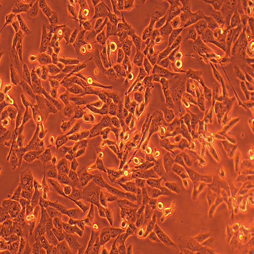 HOS-LUC（人骨肉瘤细胞-荧光素酶标记（STR鉴定正确））