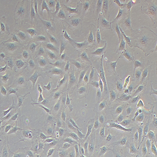 HUVEC-RFP(人脐静脉内皮细胞永生化-红色荧光蛋白标记（免疫荧光))