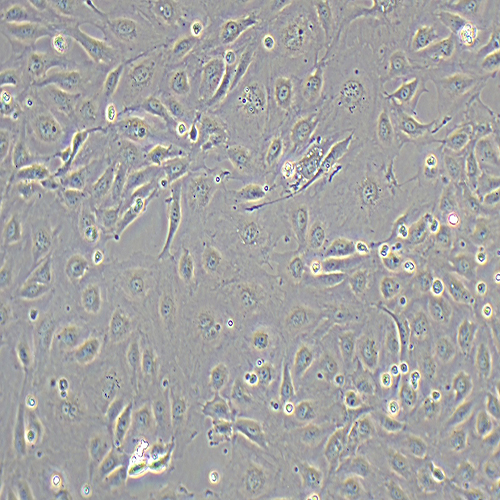 HUVEC-RFP(人脐静脉内皮细胞永生化-红色荧光蛋白标记（免疫荧光))