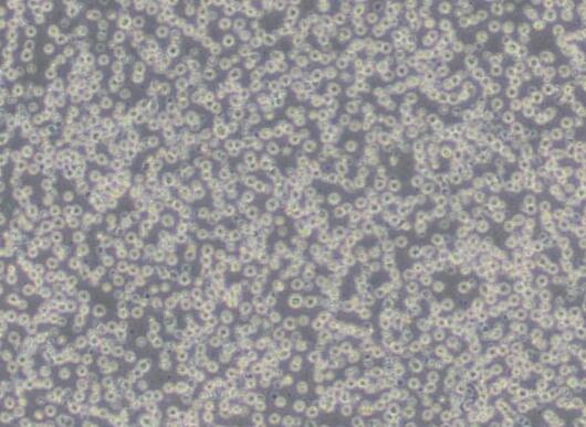 NAMALWA（人Burkitt's淋巴瘤细胞）