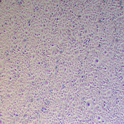 ID8-LUC（小鼠卵巢上皮癌细胞-荧光素酶标记）