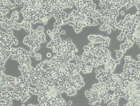 Neuro-2a [N2a; Neuro-2a]（小鼠脑神经瘤细胞）