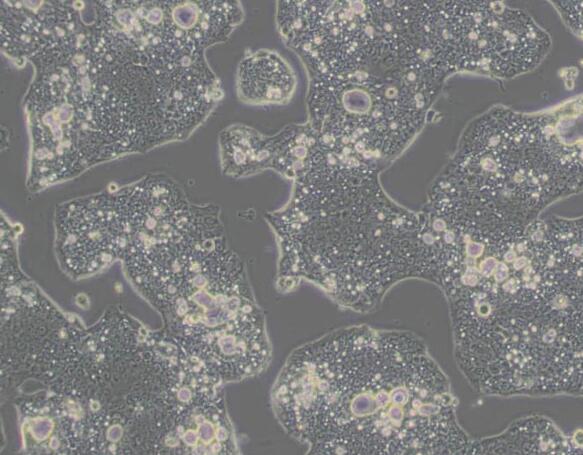 NCI-N87 [N87]（人胃癌细胞）