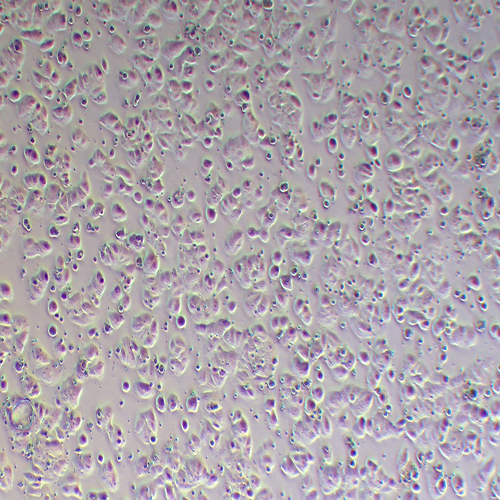 MCF-7-LUC(人乳腺癌细胞-荧光素酶标记（STR鉴定正确）)
