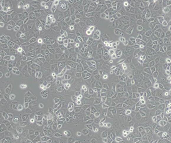 NIH:OVCAR-3 [OVCAR3]（人卵巢癌细胞）