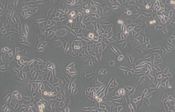 QGY-7701（人肝癌细胞）