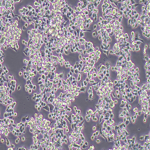 MKN-45-LUC（人胃癌细胞-荧光素酶标记（STR鉴定正确））