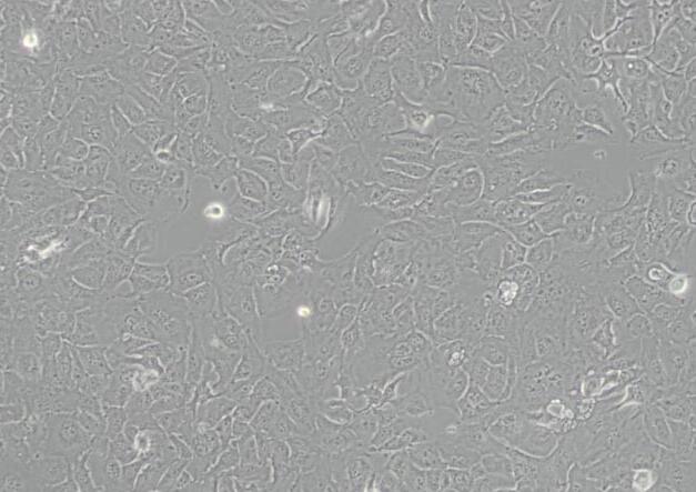 RBE（人肝胆管癌细胞）