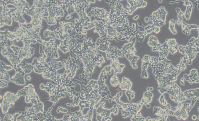 RL95-2（人子宫内膜癌细胞）