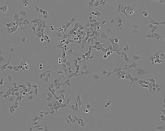 Sf21（昆虫卵巢细胞）