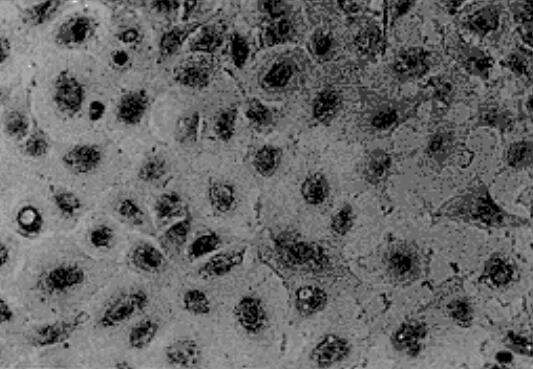 SHG-44（人胶质瘤细胞）