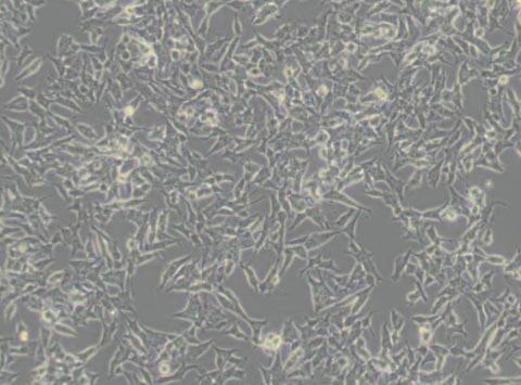 SH-SY5Y [SHSY-5Y]（人神经母细胞瘤细胞）