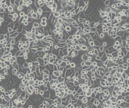 SK-BR-3 [SKBR3]（人乳腺腺癌细胞）