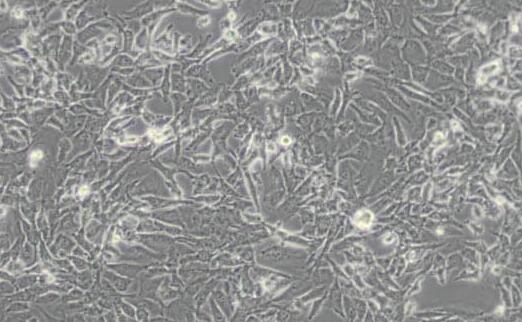 SK-Hep-1（人肝癌细胞）