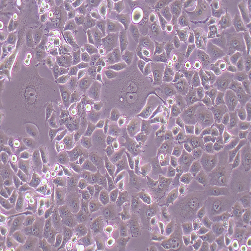PANC-1-LUC（人胰腺癌细胞-荧光素酶标记（STR鉴定正确））