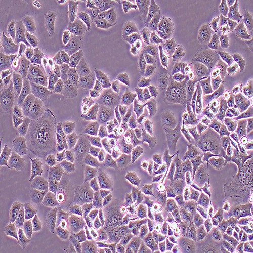 PANC-1-LUC（人胰腺癌细胞-荧光素酶标记（STR鉴定正确））