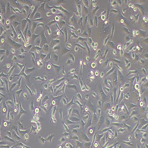 PC-3-LUC（人前列腺癌细胞-荧光素酶标记（STR鉴定正确））