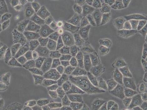 SPC-A-1（人肺腺癌细胞）