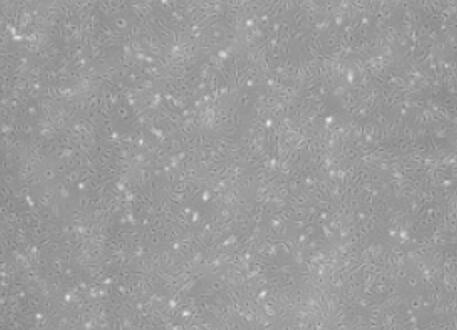 SVEC4-10（小鼠淋巴结内皮细胞）