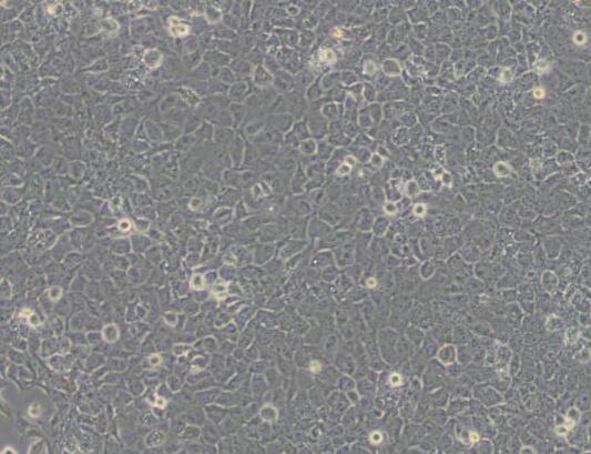 T24 [T-24]（人膀胱移行细胞癌细胞）