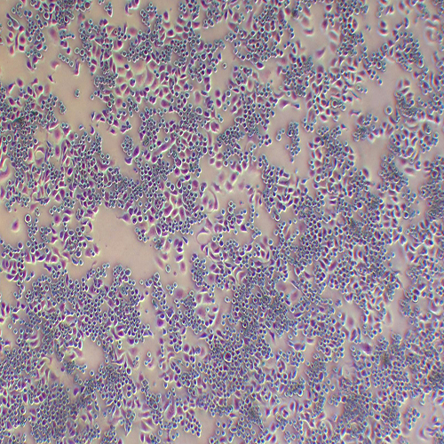 SK-BR-3-LUC（人乳腺癌细胞-荧光素酶标记（STR鉴定正确））