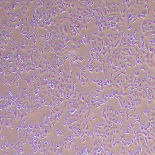SK-MEL-2-LUC(人皮肤黑色素瘤细胞-荧光素酶标记（STR鉴定正确）)