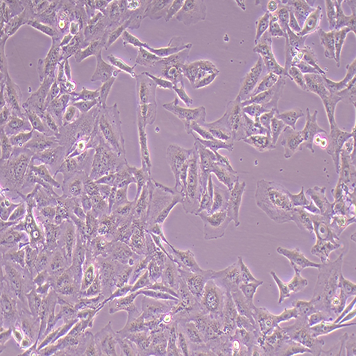 SK-MEL-2-LUC(人皮肤黑色素瘤细胞-荧光素酶标记（STR鉴定正确）)