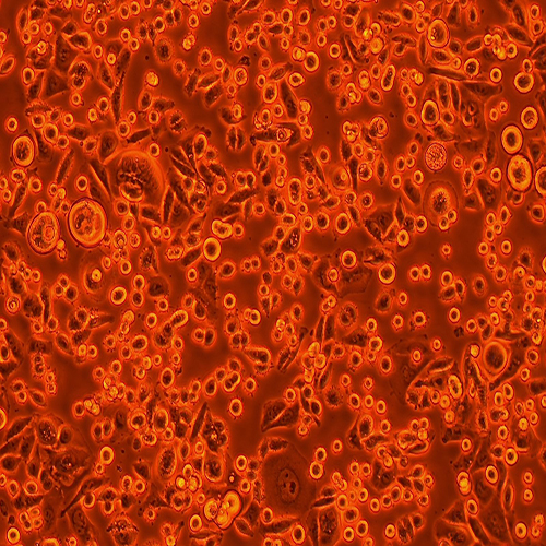 SW480-LUC（人结肠腺癌细胞-荧光素酶标记（STR鉴定正确））