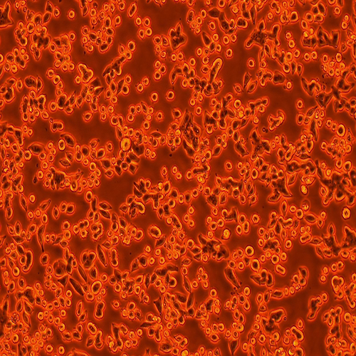 SW620-LUC（人结直肠腺癌细胞-荧光素酶标记（STR鉴定正确））