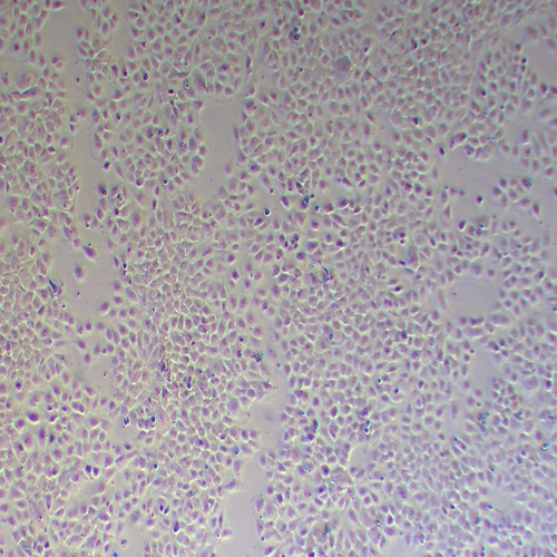 T24-LUC（人膀胱癌细胞-荧光素酶标记（STR鉴定正确））