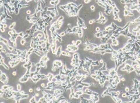 VCaP（人前列腺癌细胞）