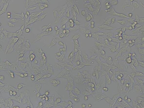 Y1 [Y-1]（小鼠肾上腺皮质瘤细胞）