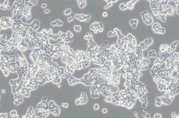 ZR-75-1（人乳腺癌细胞）