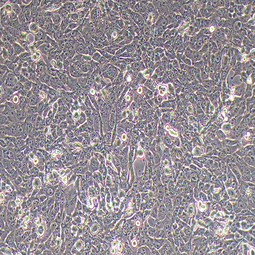 T47D-LUC（人乳腺癌细胞-荧光素酶标记（STR鉴定正确））