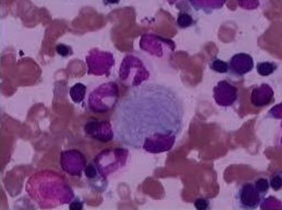 BC-022（人乳腺癌细胞）