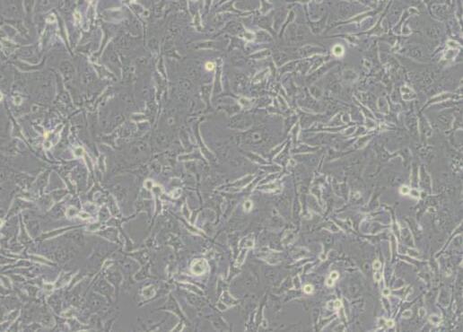 CAL 27（人舌鳞癌细胞）