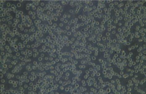 LS 180（人结肠腺癌细胞）