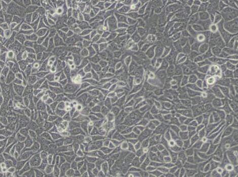 CNE-2Z（人鼻咽癌细胞）