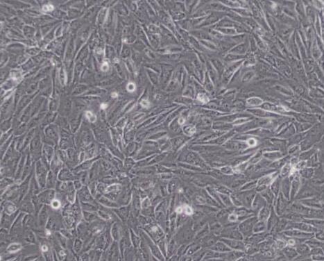 EA.hy926（人脐静脉细胞融合细胞）