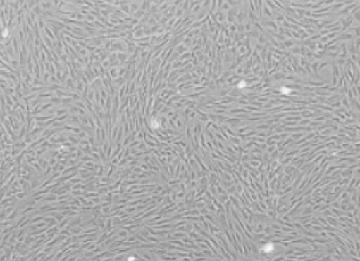 ECV-304（人脐静脉内皮细胞）