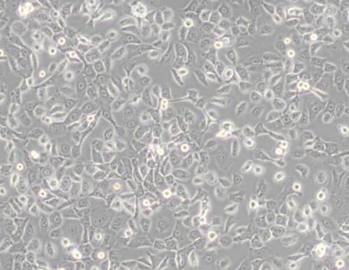 HCC 94 [HCC941122]（人子宫鳞癌细胞(高分化)）