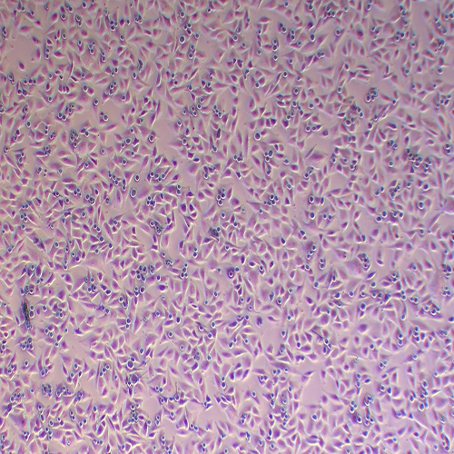 U87-MG-LUC（人脑星形胶质母细胞瘤-荧光素酶标记（STR鉴定正确））