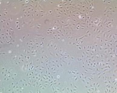 M1（小鼠白血病细胞）