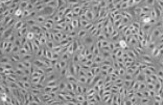 MKN-28（人胃癌高转移细胞）