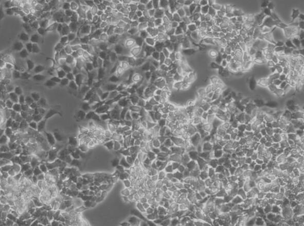 MV3（人黑色素瘤细胞）