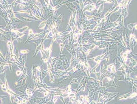 NCI-H1975（人肺腺癌细胞）